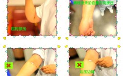 面对抽血不痛的小技巧