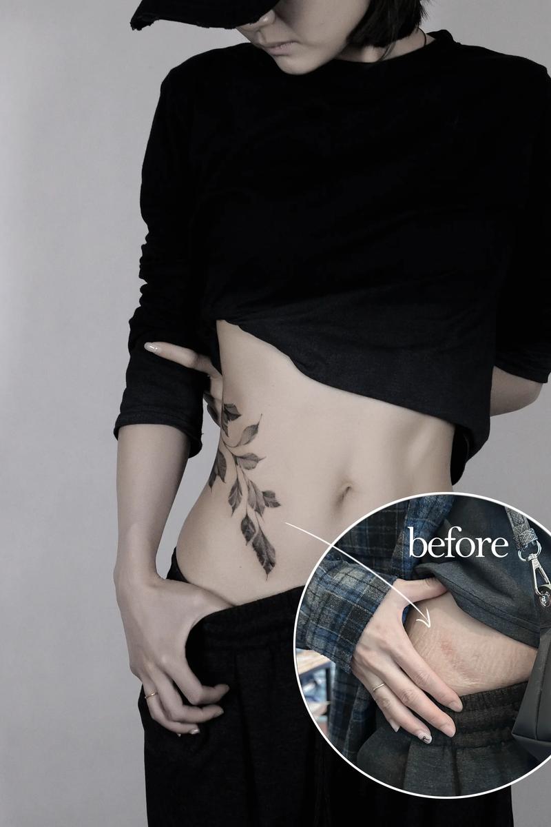 疤痕创意纹身-图1 疤痕创意纹身-图1