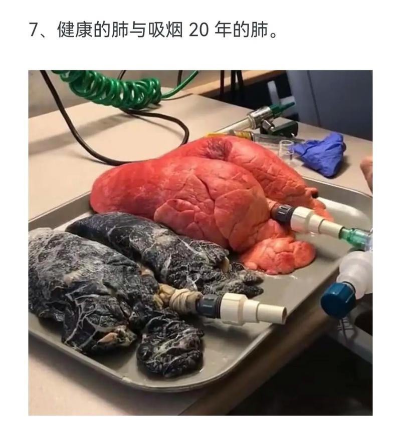 烟与肺创意图-图2