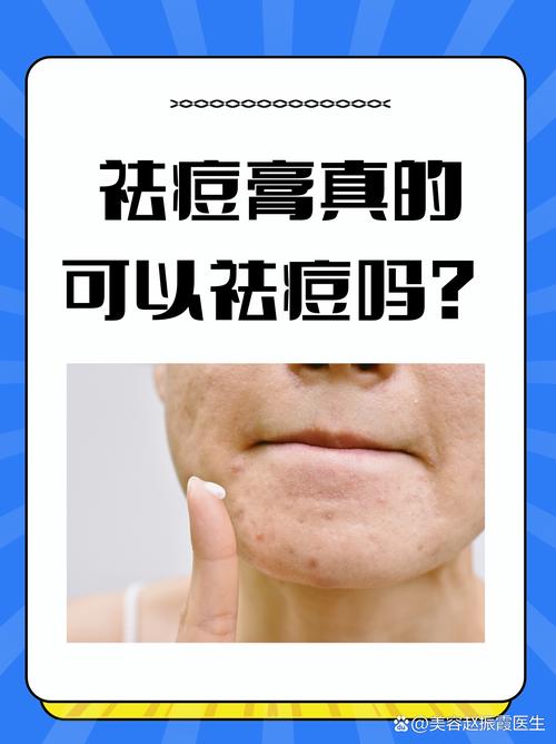 祛痘创意广告-图3 祛痘创意广告-图3