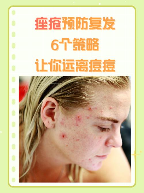 祛痘创意广告-图1 祛痘创意广告-图1