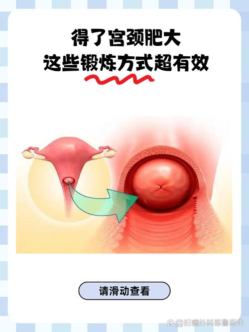 妇科治疗拓展技巧-图3